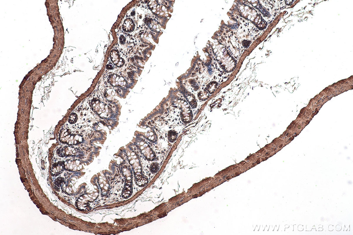 Immunohistochemical analysis of paraffin-embedded rat colon tissue slide using KHC0892 (CNN3 IHC Kit).