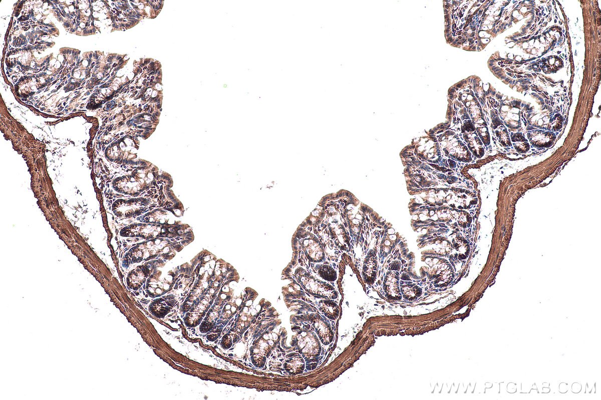 Immunohistochemical analysis of paraffin-embedded mouse colon tissue slide using KHC0892 (CNN3 IHC Kit).