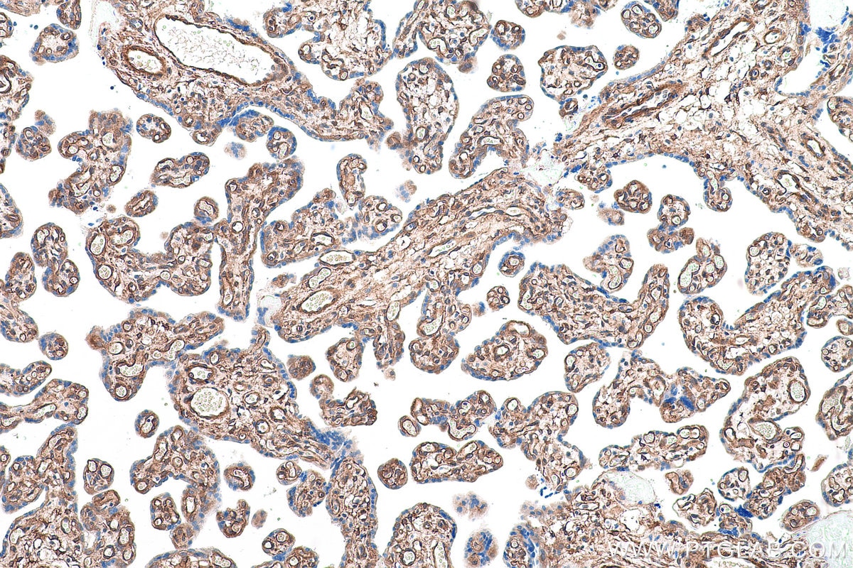 Immunohistochemical analysis of paraffin-embedded human placenta tissue slide using KHC0892 (CNN3 IHC Kit).