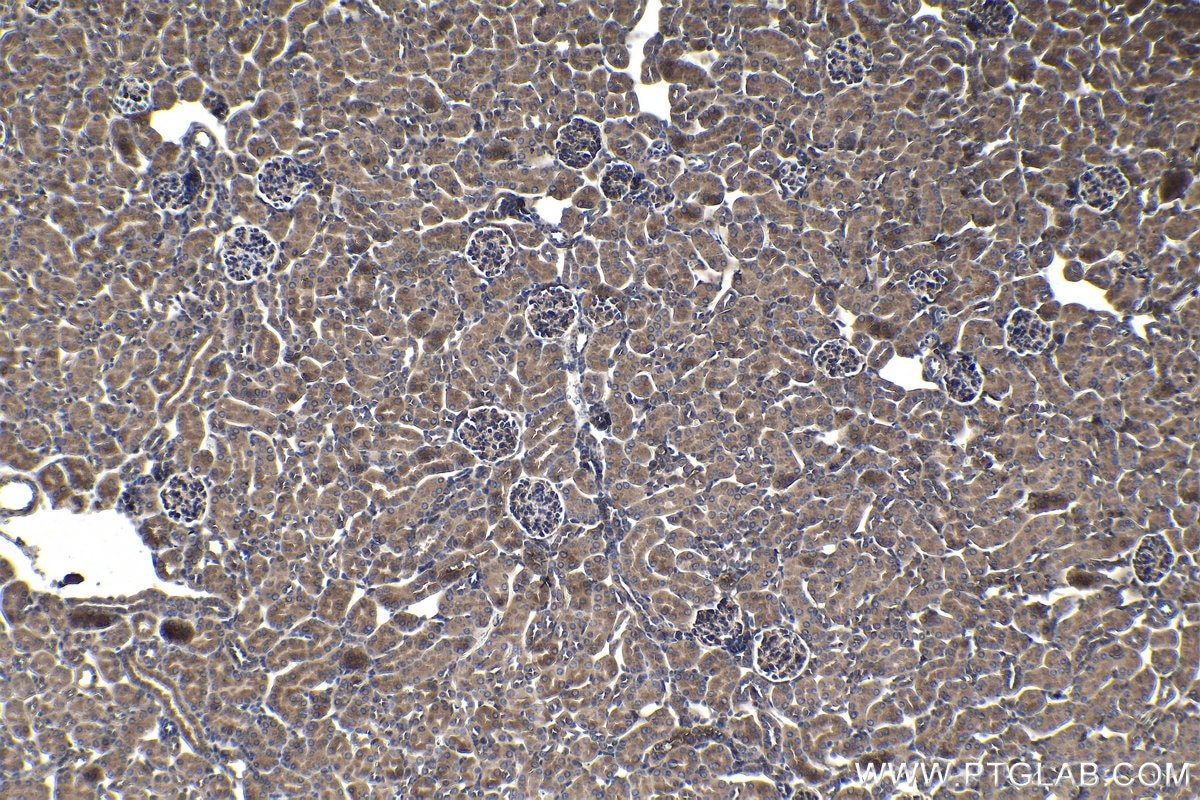 Immunohistochemical analysis of paraffin-embedded mouse kidney tissue slide using KHC1415 (CNOT1 IHC Kit).