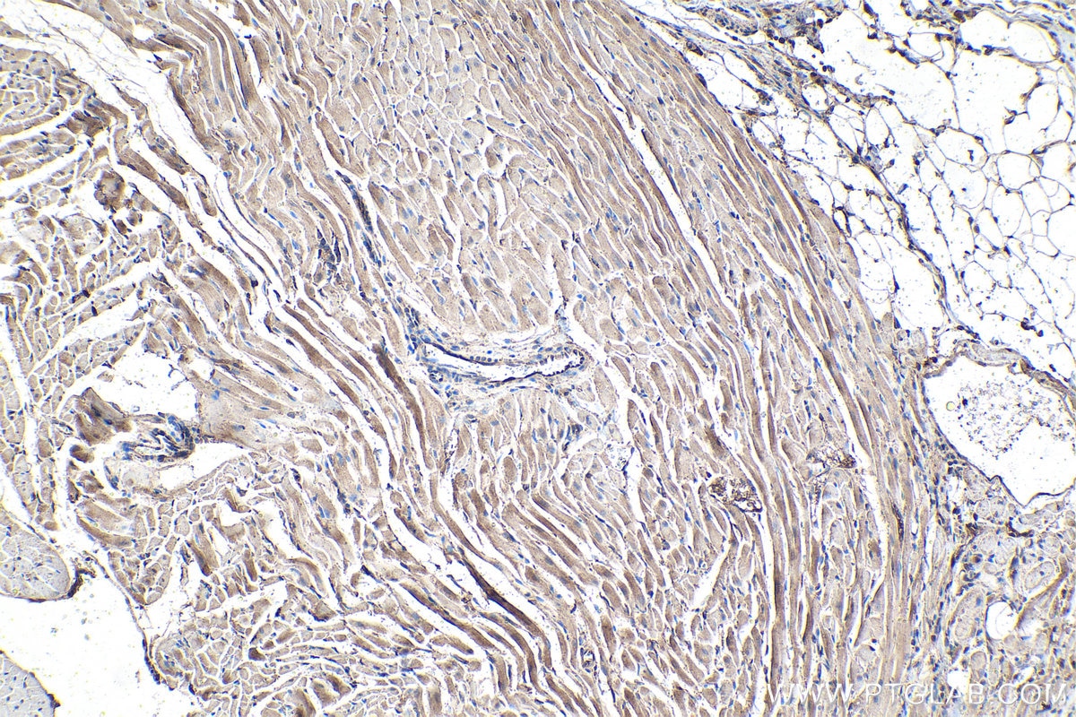 Immunohistochemical analysis of paraffin-embedded rat heart tissue slide using KHC1415 (CNOT1 IHC Kit).