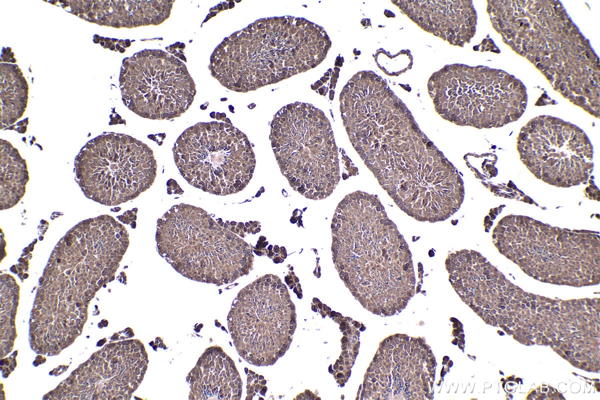 Immunohistochemical analysis of paraffin-embedded mouse testis tissue slide using KHC1471 (CNOT3 IHC Kit).