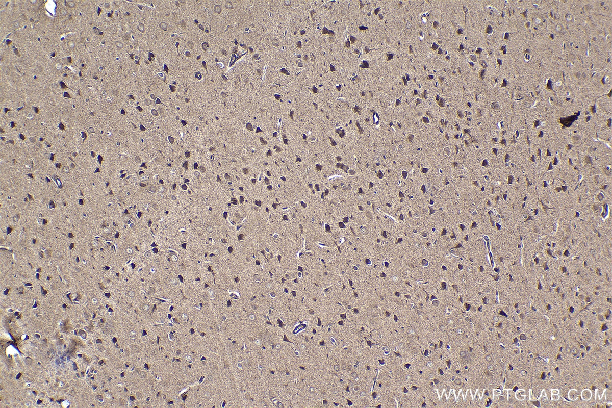 Immunohistochemical analysis of paraffin-embedded rat brain tissue slide using KHC1471 (CNOT3 IHC Kit).
