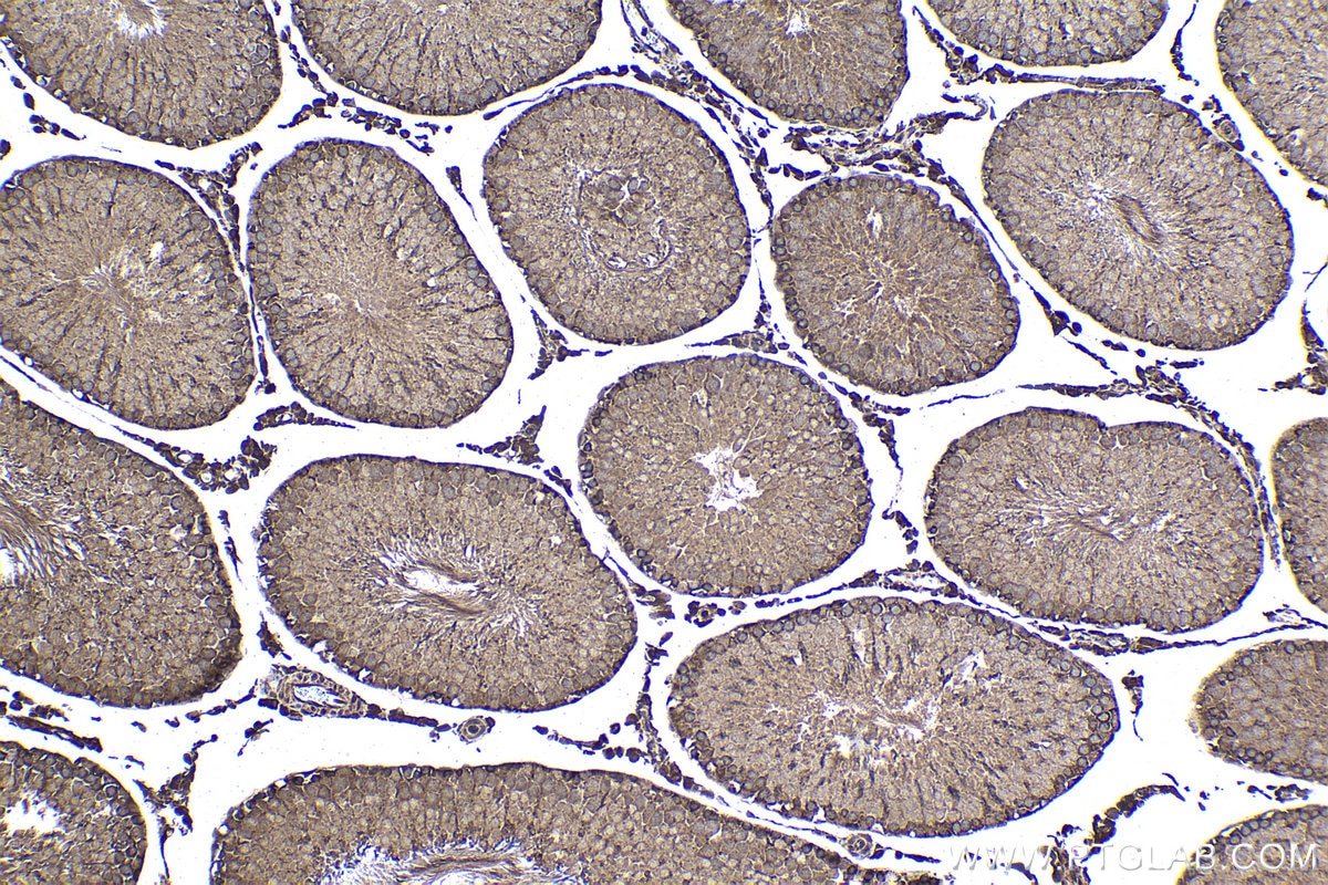 Immunohistochemical analysis of paraffin-embedded rat testis tissue slide using KHC1471 (CNOT3 IHC Kit).