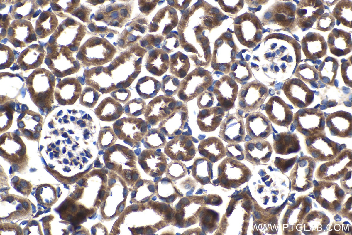 Immunohistochemical analysis of paraffin-embedded mouse kidney tissue slide using KHC1497 (CNOT4 IHC Kit).