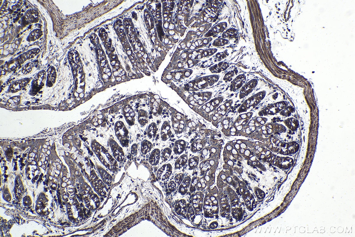 Immunohistochemical analysis of paraffin-embedded mouse colon tissue slide using KHC1497 (CNOT4 IHC Kit).