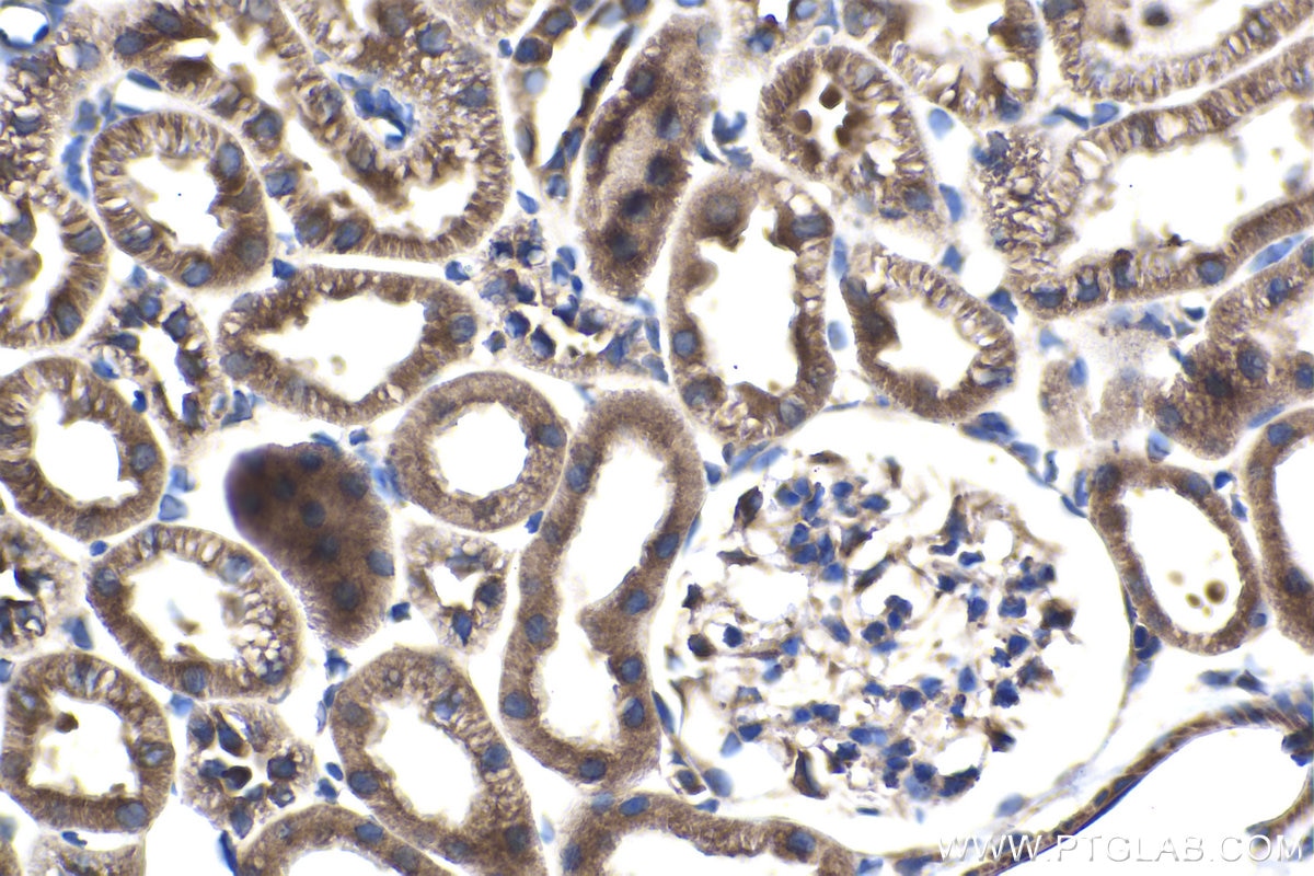Immunohistochemical analysis of paraffin-embedded rat kidney tissue slide using KHC1497 (CNOT4 IHC Kit).