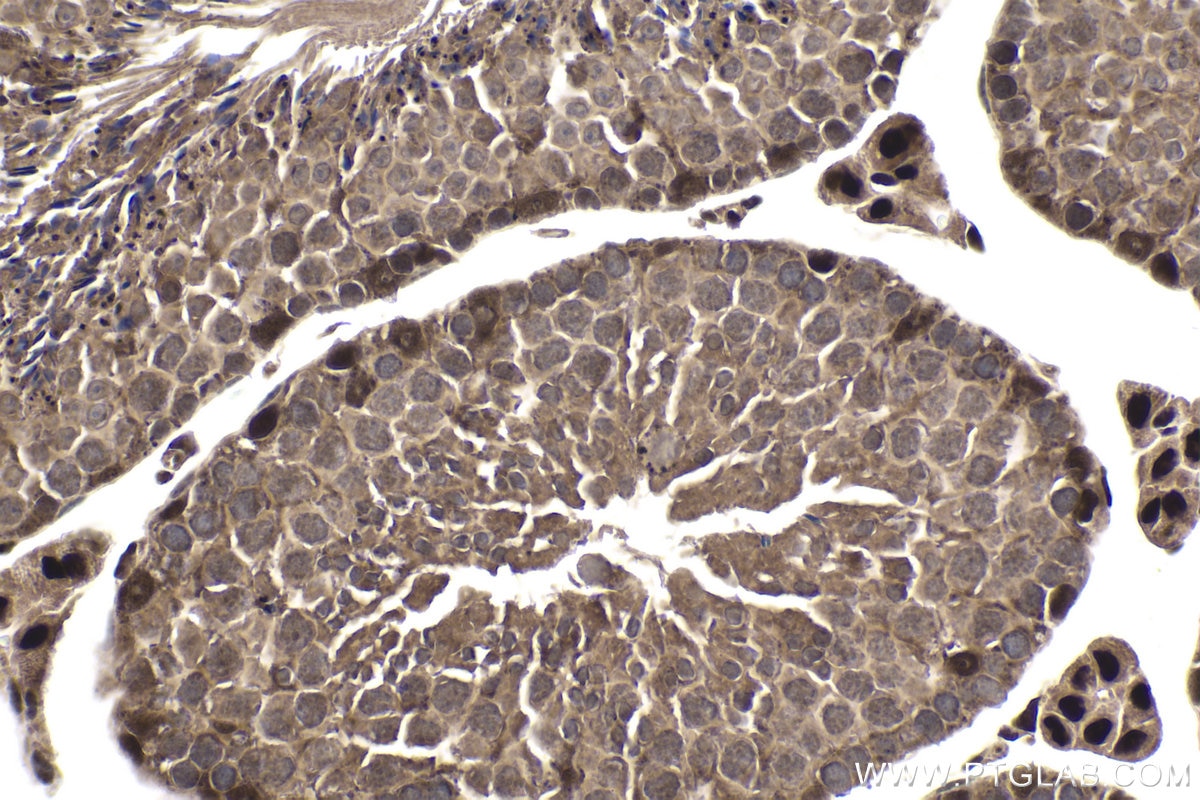 Immunohistochemical analysis of paraffin-embedded mouse testis tissue slide using KHC1978 (CNOT8 IHC Kit).