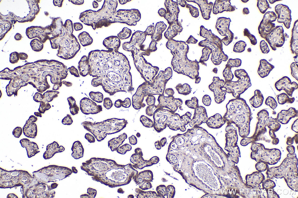Immunohistochemical analysis of paraffin-embedded human placenta tissue slide using KHC1978 (CNOT8 IHC Kit).
