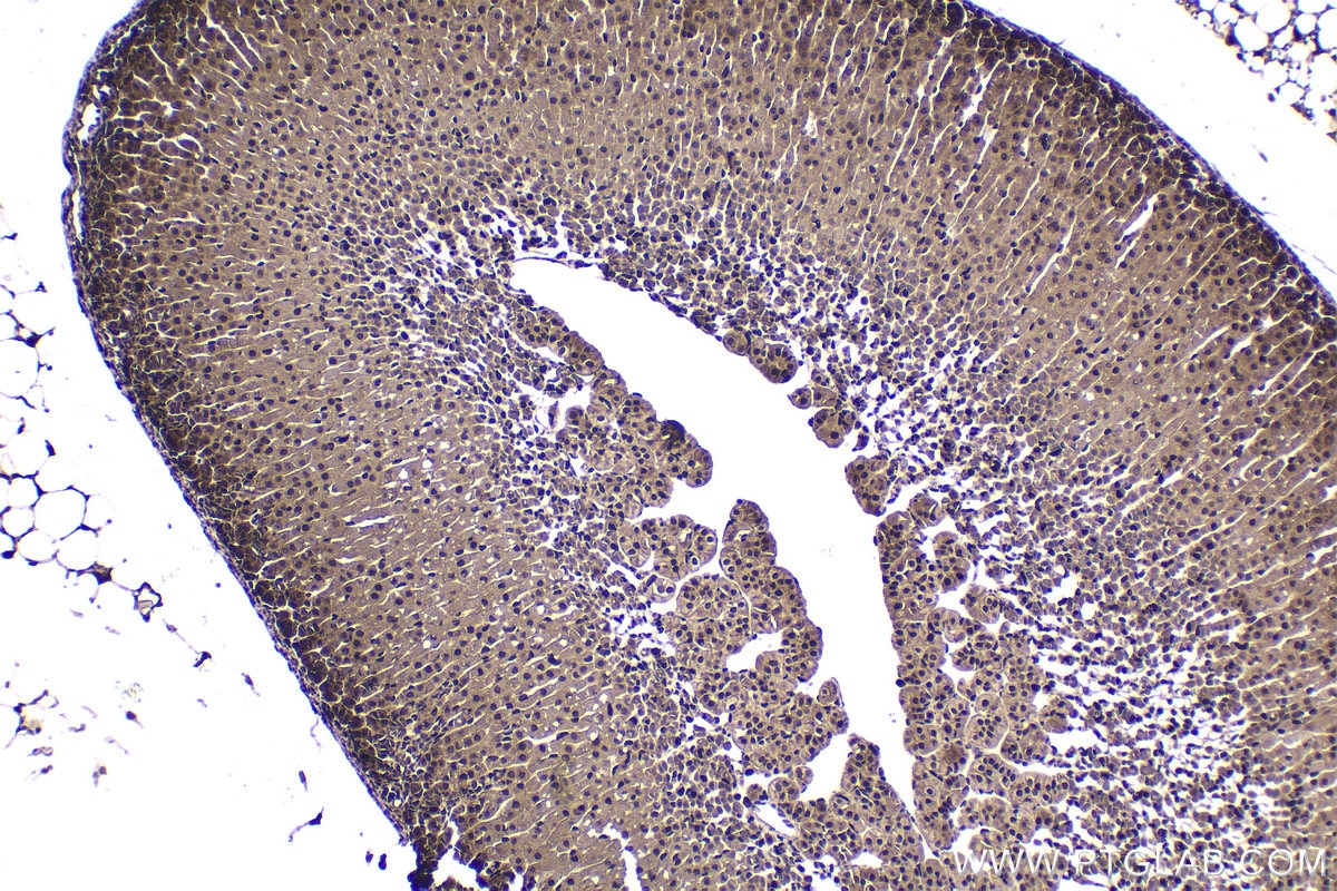Immunohistochemical analysis of paraffin-embedded mouse adrenal gland tissue slide using KHC1978 (CNOT8 IHC Kit).