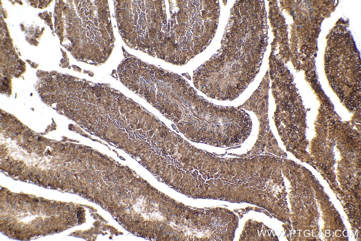 Immunohistochemical analysis of paraffin-embedded mouse testis tissue slide using KHC0999 (CNOT9 IHC Kit).