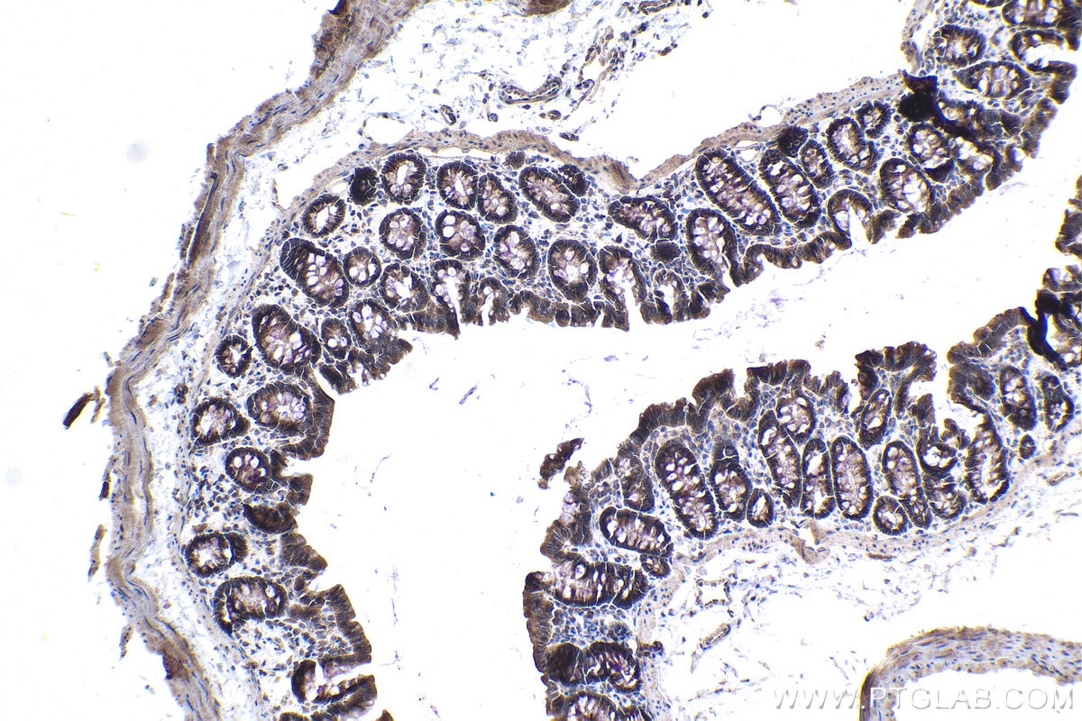 Immunohistochemical analysis of paraffin-embedded rat colon tissue slide using KHC0999 (CNOT9 IHC Kit).