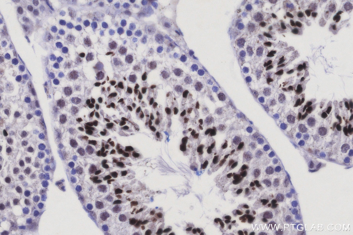 Immunohistochemical analysis of paraffin-embedded mouse testis tissue slide using KHC3128 (CNTD1 IHC Kit).