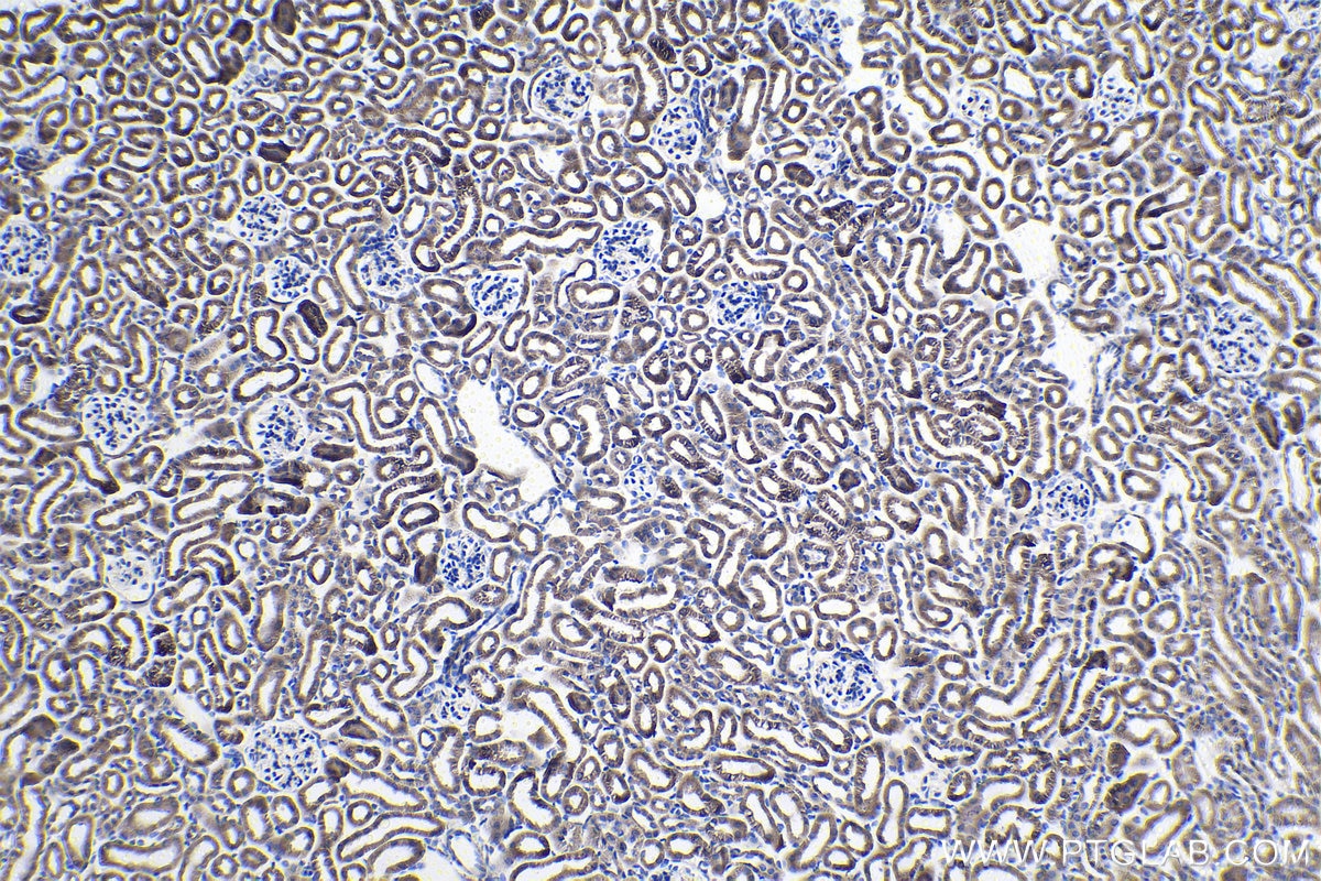 Immunohistochemical analysis of paraffin-embedded mouse kidney tissue slide using KHC1023 (COA6 IHC Kit).