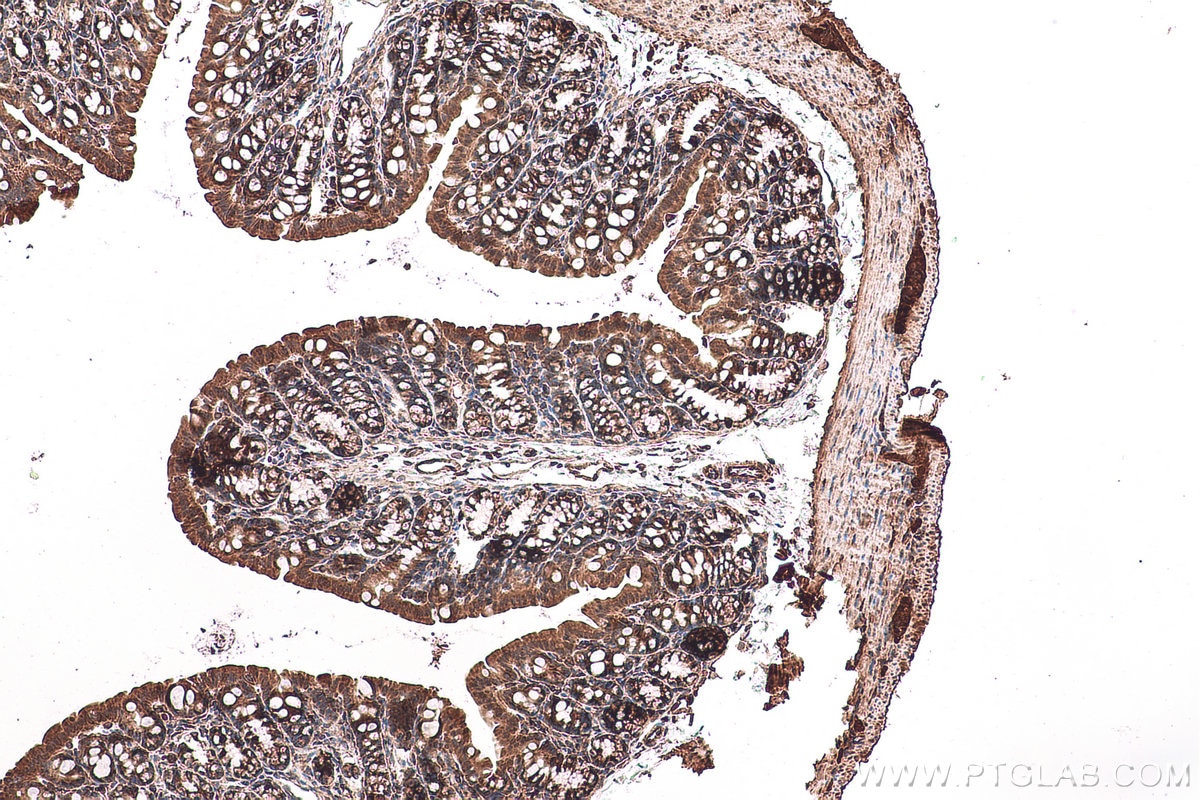 Immunohistochemical analysis of paraffin-embedded mouse colon tissue slide using KHC0987 (COA7/C1orf163 IHC Kit).