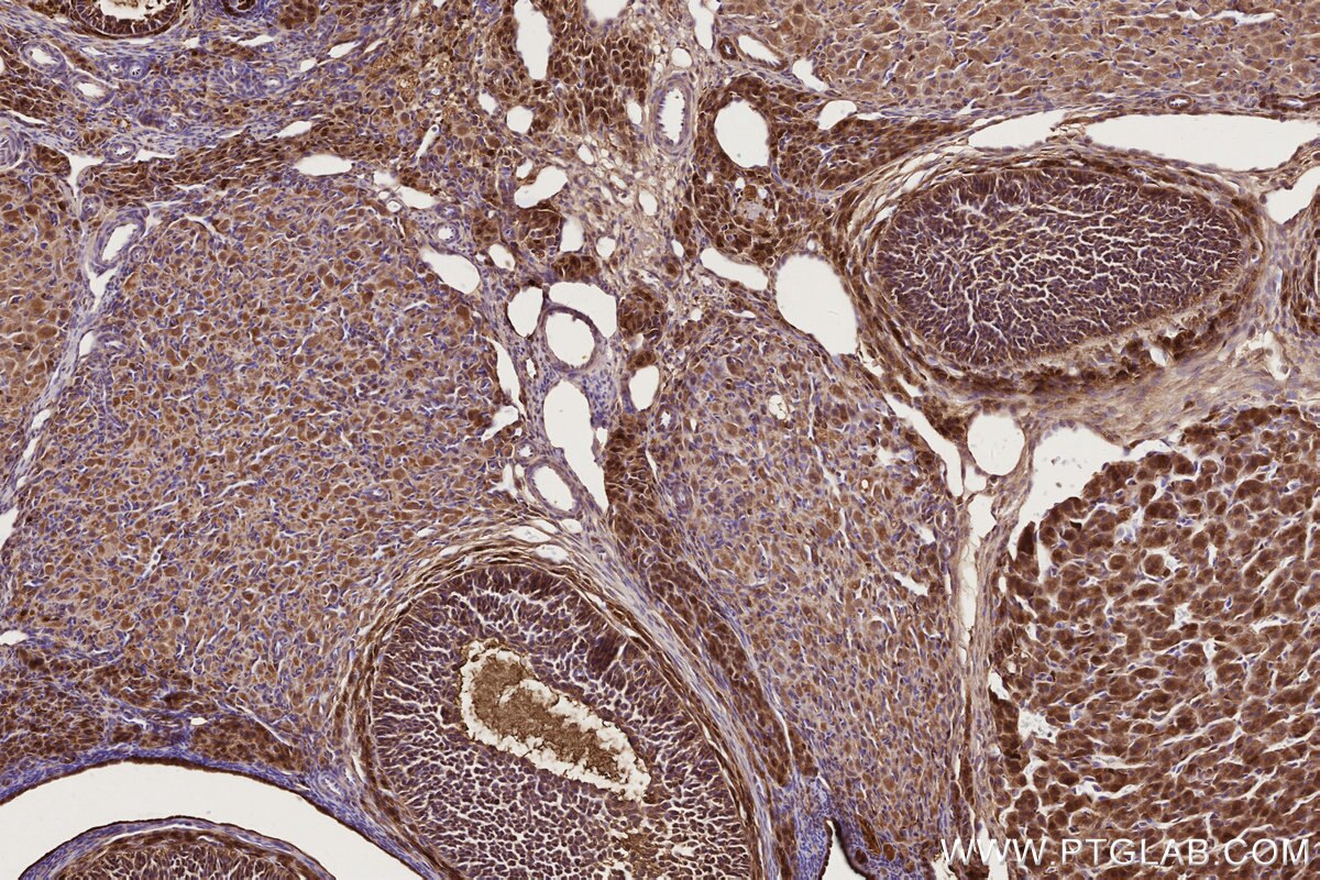 Immunohistochemical analysis of paraffin-embedded rat ovary tissue slide using KHC2729 (COG1 IHC Kit).