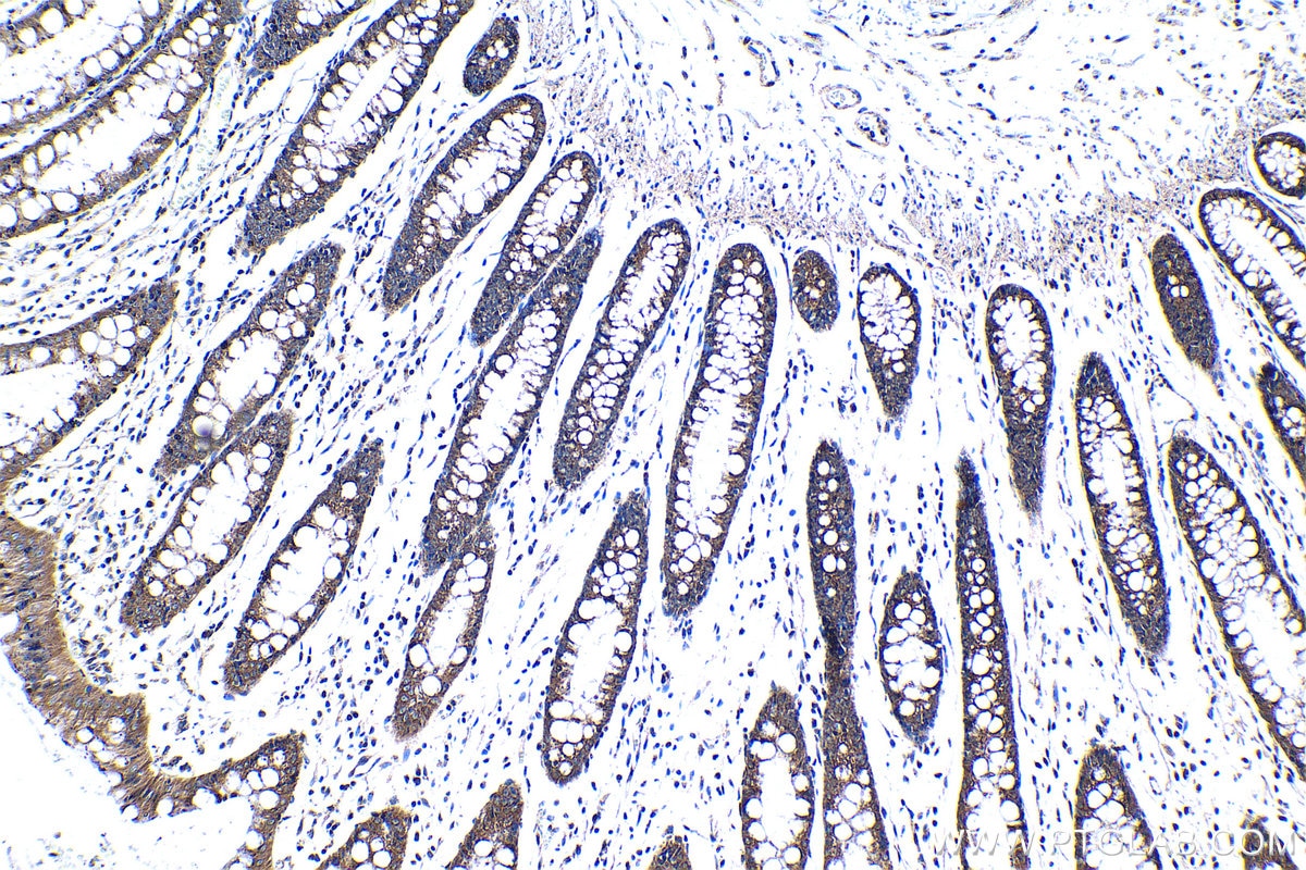 Immunohistochemical analysis of paraffin-embedded human colon tissue slide using KHC1292 (COG3 IHC Kit).