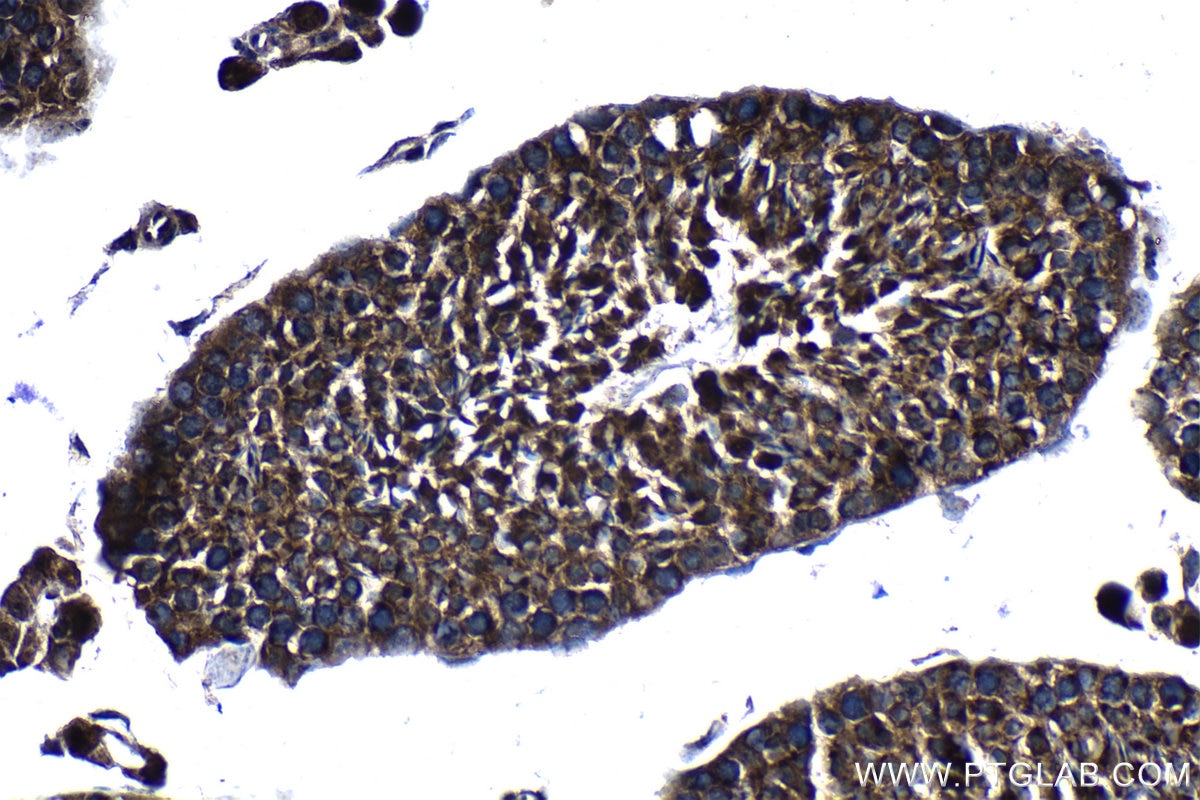 Immunohistochemical analysis of paraffin-embedded mouse testis tissue slide using KHC1292 (COG3 IHC Kit).