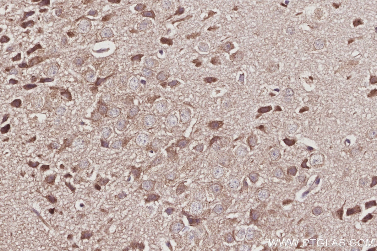 Immunohistochemical analysis of paraffin-embedded mouse brain tissue slide using KHC3046 (COG5 IHC Kit). Immunohistochemical analysis of paraffin-embedded mouse brain tissue slide using KHC3046 (COG5 IHC Kit).