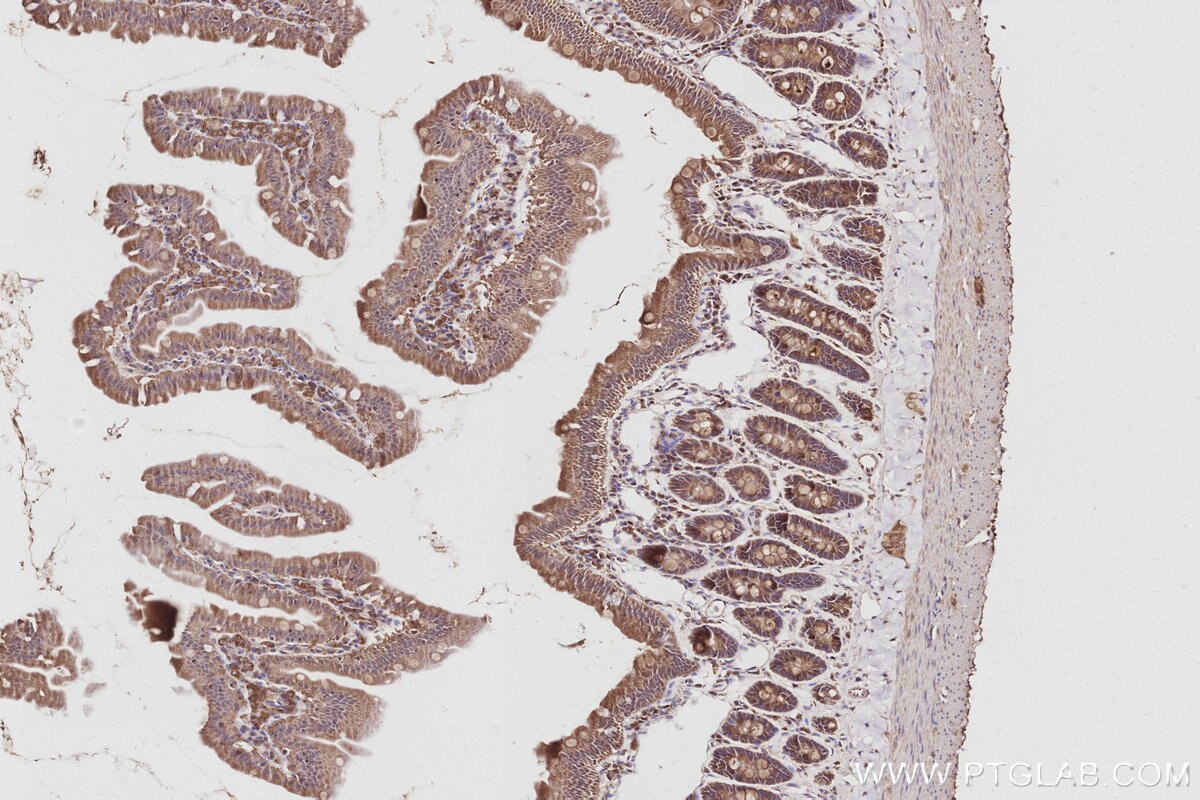 Immunohistochemical analysis of paraffin-embedded rat small intestine tissue slide using KHC3046 (COG5 IHC Kit). Immunohistochemical analysis of paraffin-embedded rat small intestine tissue slide using KHC3046 (COG5 IHC Kit).