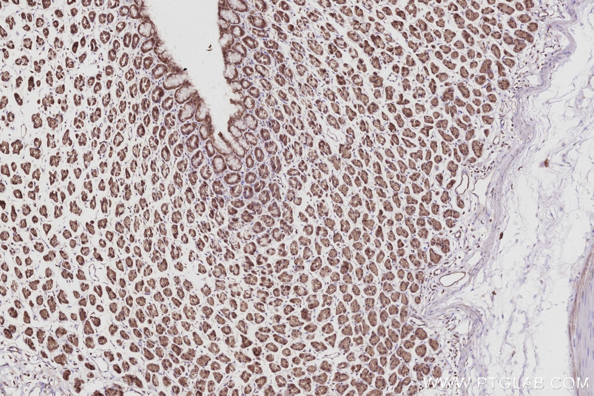 Immunohistochemical analysis of paraffin-embedded rat stomach tissue slide using KHC3046 (COG5 IHC Kit). Immunohistochemical analysis of paraffin-embedded rat stomach tissue slide using KHC3046 (COG5 IHC Kit).