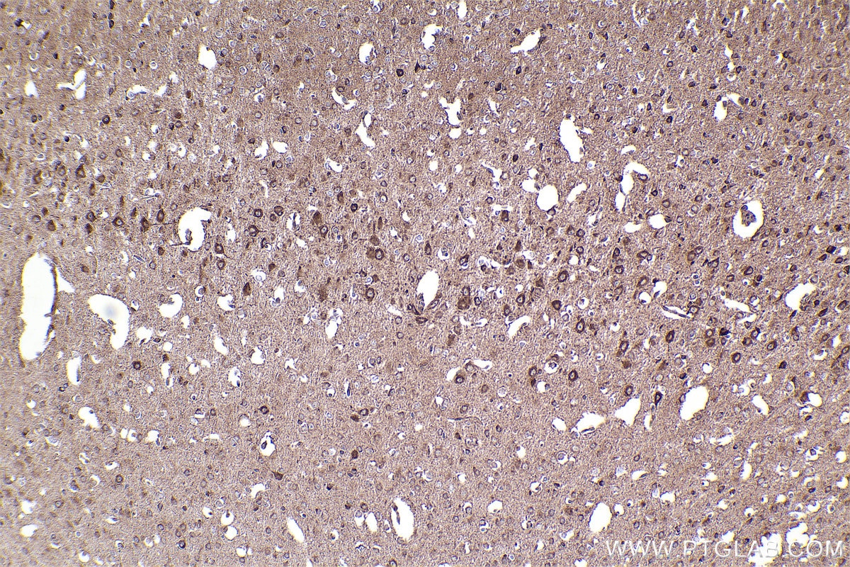 Immunohistochemical analysis of paraffin-embedded mouse brain tissue slide using KHC2371 (COG7 IHC Kit).
