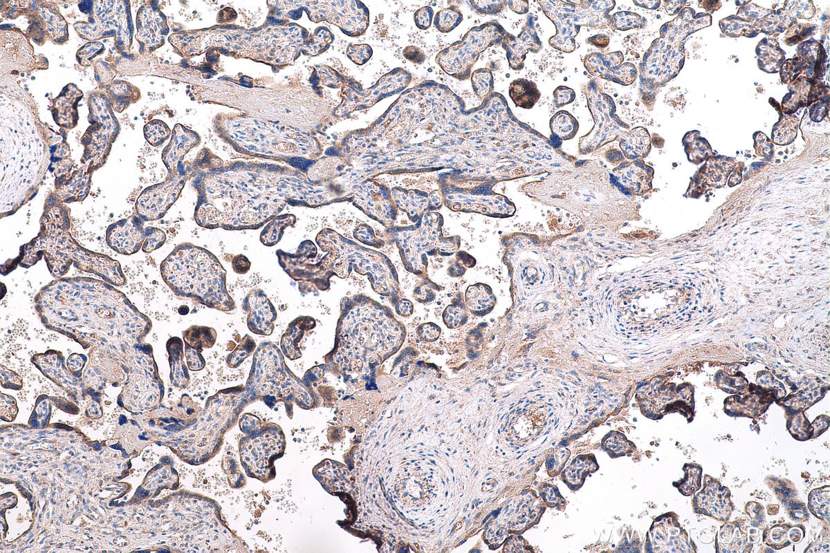 Immunohistochemical analysis of paraffin-embedded human placenta tissue slide using KHC0744 (COL11A1 IHC Kit).