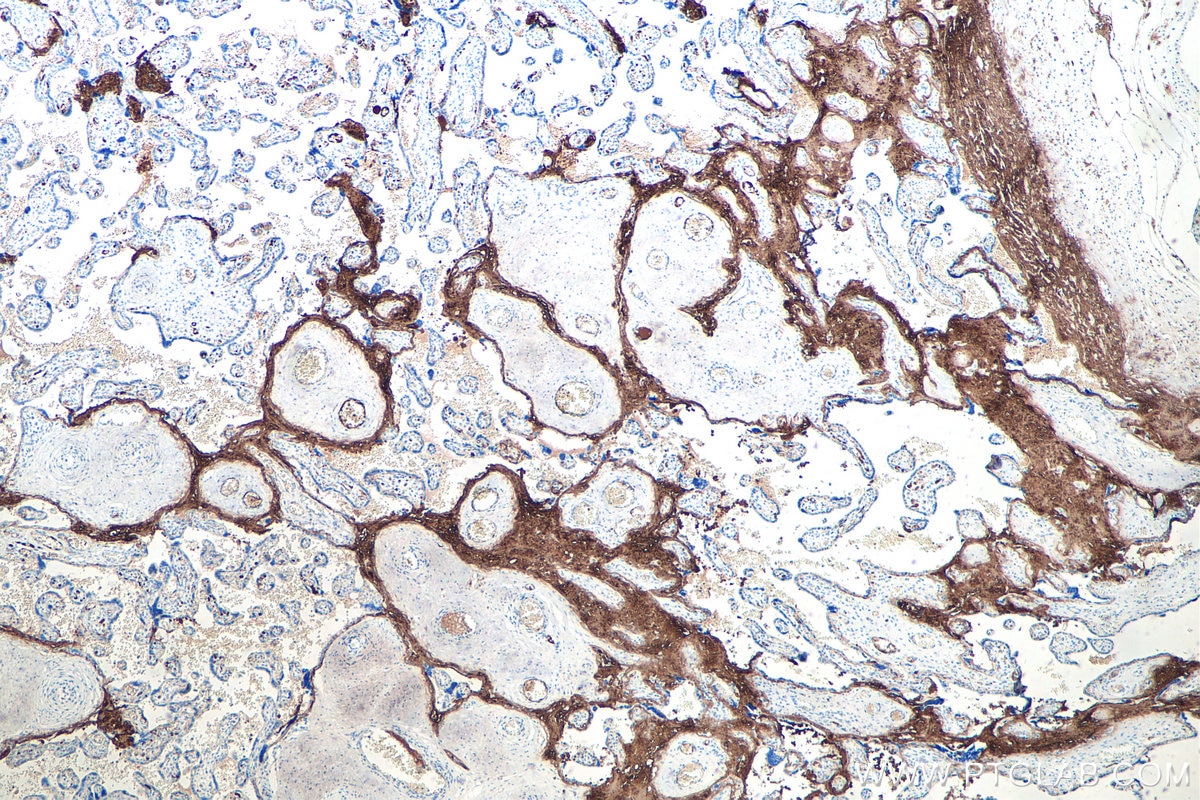 Immunohistochemical analysis of paraffin-embedded human placenta tissue slide using KHC0742 (COL5A1 IHC Kit).