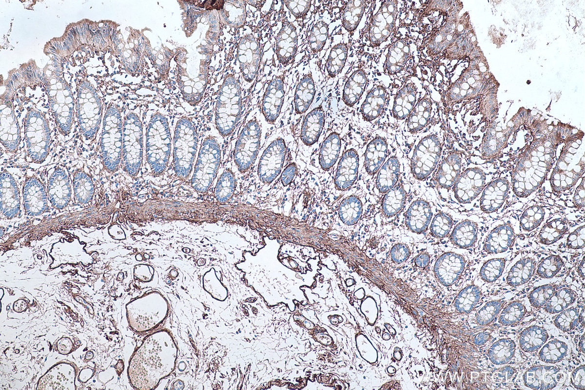 Immunohistochemical analysis of paraffin-embedded human colon tissue slide using KHC0314 (COL6A1 IHC Kit).