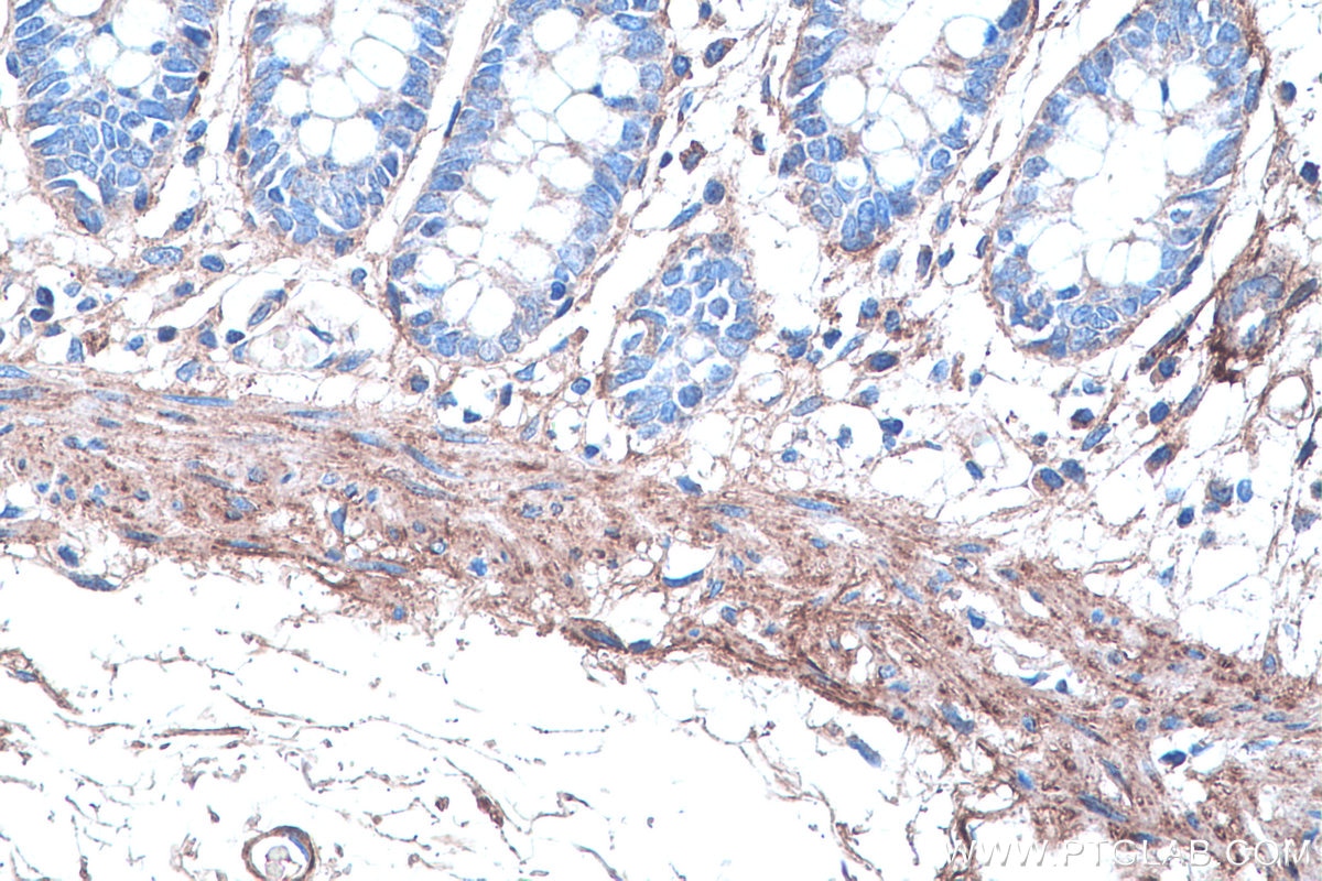 Immunohistochemical analysis of paraffin-embedded human colon tissue slide using KHC0315 (COL6A2 IHC Kit).