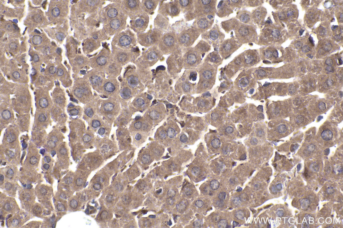 Immunohistochemical analysis of paraffin-embedded mouse liver tissue slide using KHC1832 (COMMD1 IHC Kit).