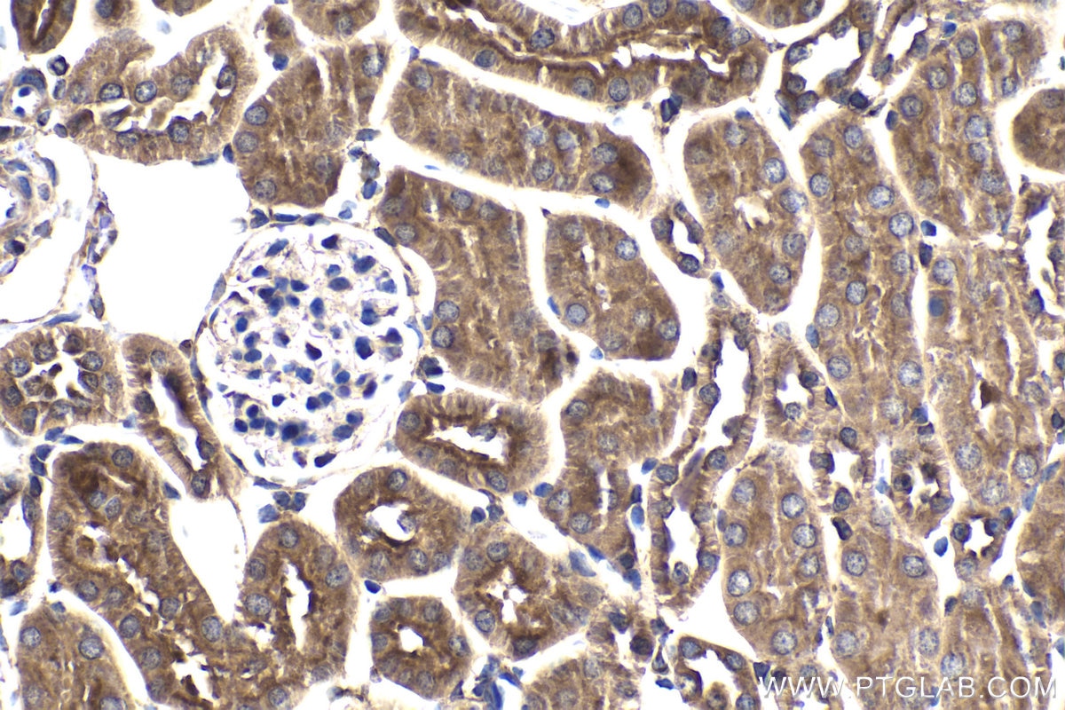 Immunohistochemical analysis of paraffin-embedded mouse kidney tissue slide using KHC1832 (COMMD1 IHC Kit).