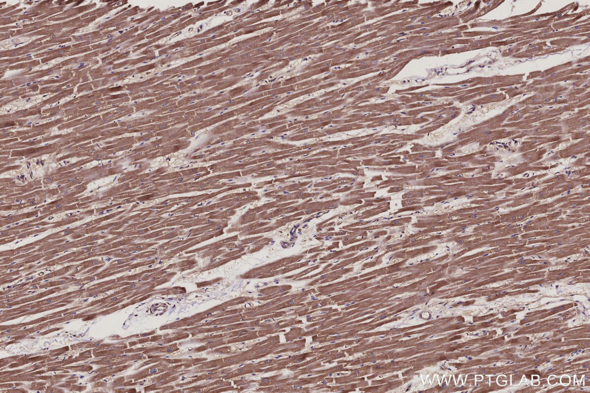Immunohistochemical analysis of paraffin-embedded human heart tissue slide using KHC3117 (COMMD5 IHC Kit). Immunohistochemical analysis of paraffin-embedded human heart tissue slide using KHC3117 (COMMD5 IHC Kit).