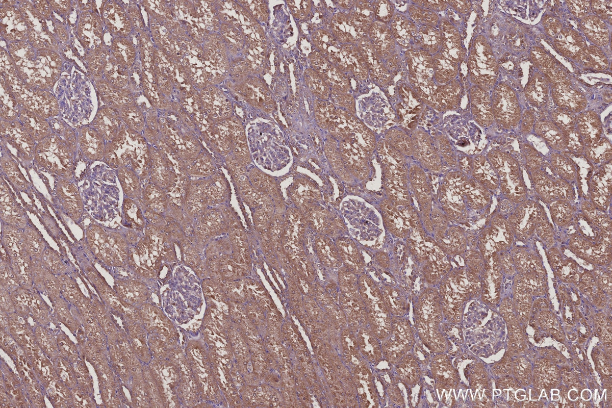 Immunohistochemical analysis of paraffin-embedded human kidney tissue slide using KHC3117 (COMMD5 IHC Kit). Immunohistochemical analysis of paraffin-embedded human kidney tissue slide using KHC3117 (COMMD5 IHC Kit).