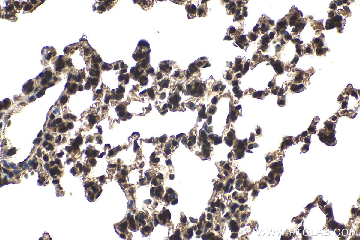 Immunohistochemical analysis of paraffin-embedded mouse lung tissue slide using KHC1639 (COPS2 IHC Kit).