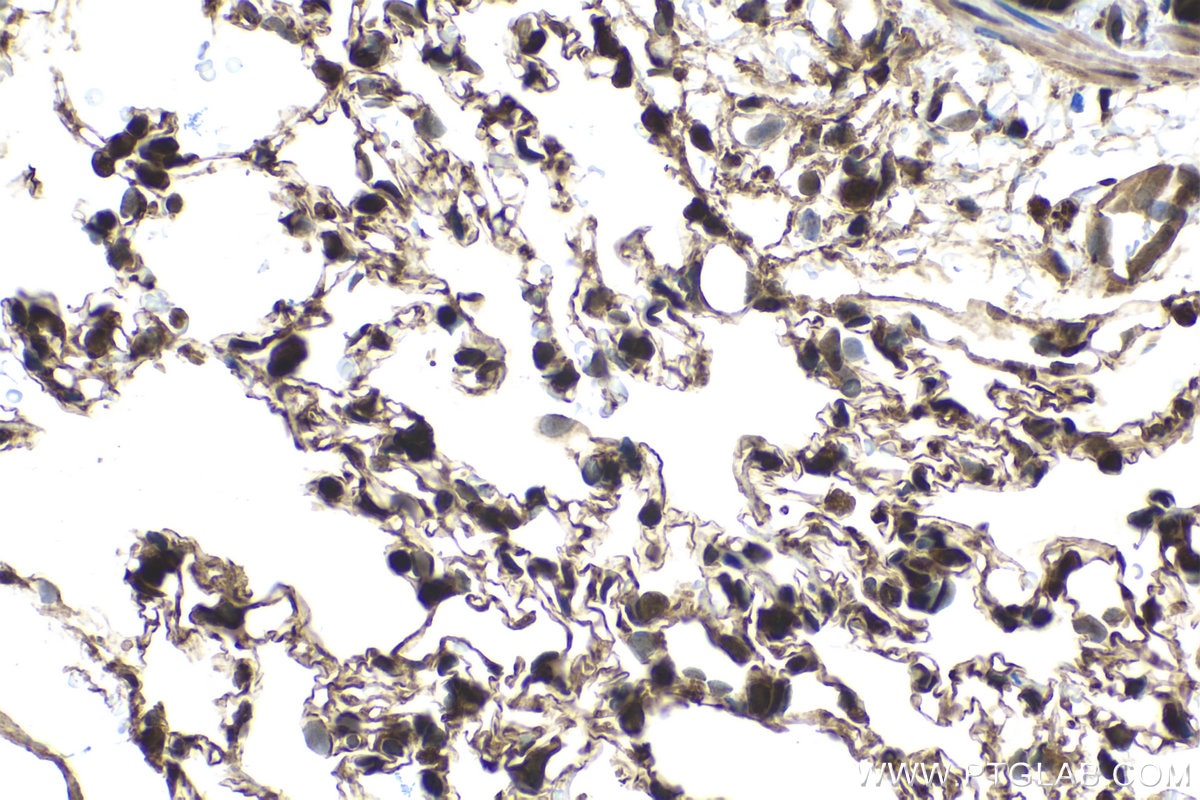 Immunohistochemical analysis of paraffin-embedded rat lung tissue slide using KHC1639 (COPS2 IHC Kit).