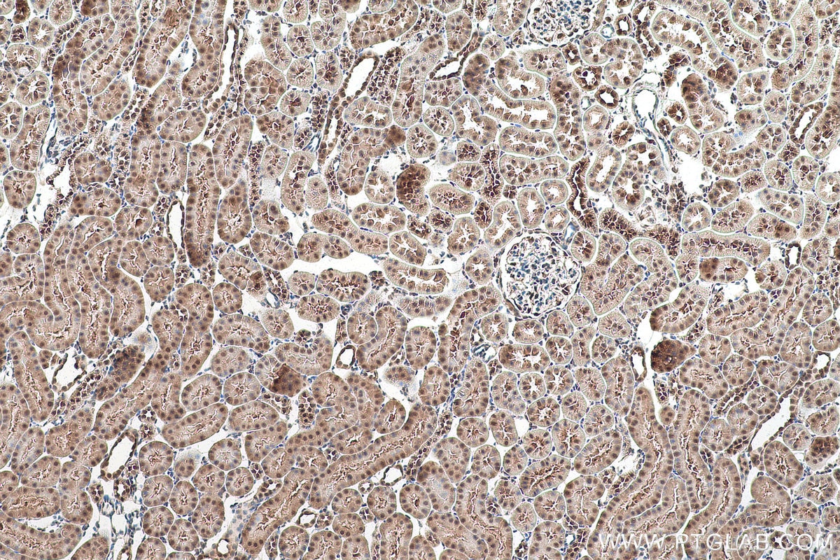 Immunohistochemical analysis of paraffin-embedded rat kidney tissue slide using KHC0921 (COPS5/JAB1 IHC Kit).