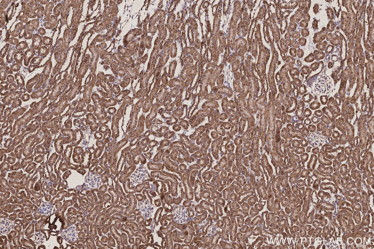 Immunohistochemical analysis of paraffin-embedded mouse kidney tissue slide using KHC3179 (COX6A1 IHC Kit).