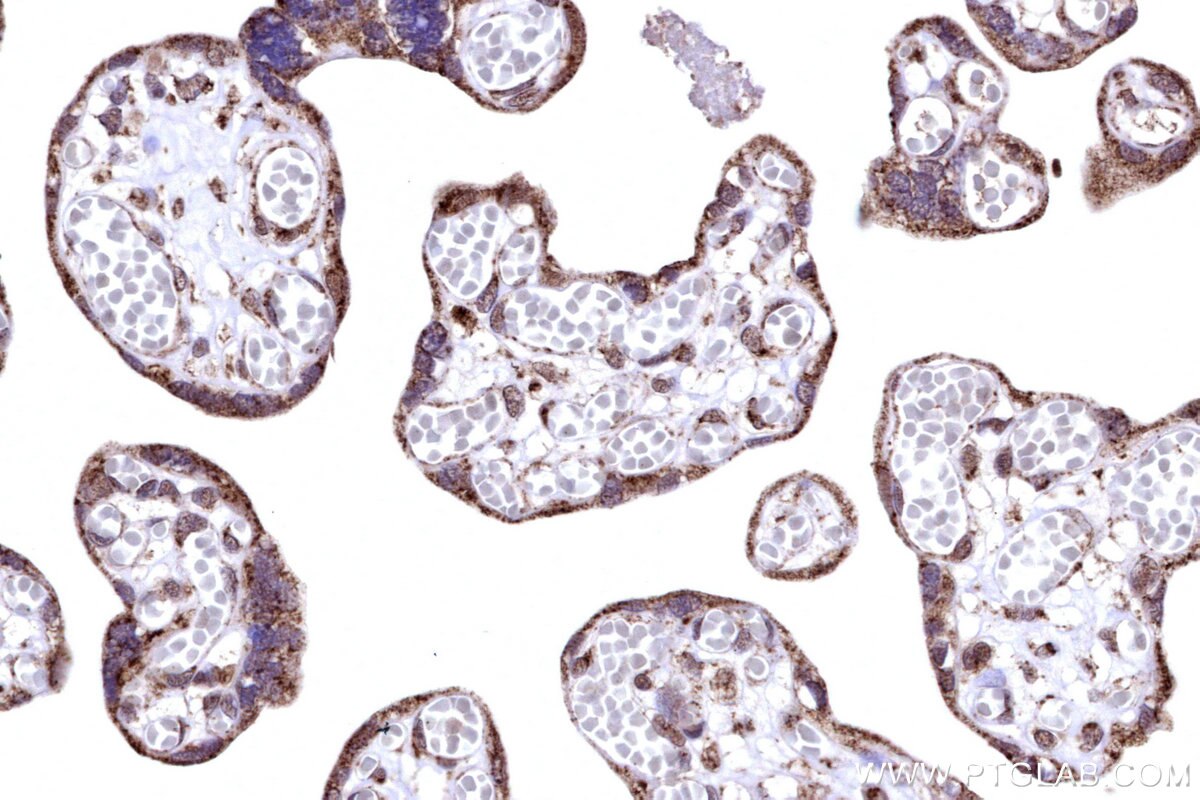Immunohistochemical analysis of paraffin-embedded human placenta tissue slide using KHC3183 (COX6B1 IHC Kit). Immunohistochemical analysis of paraffin-embedded human placenta tissue slide using KHC3183 (COX6B1 IHC Kit).
