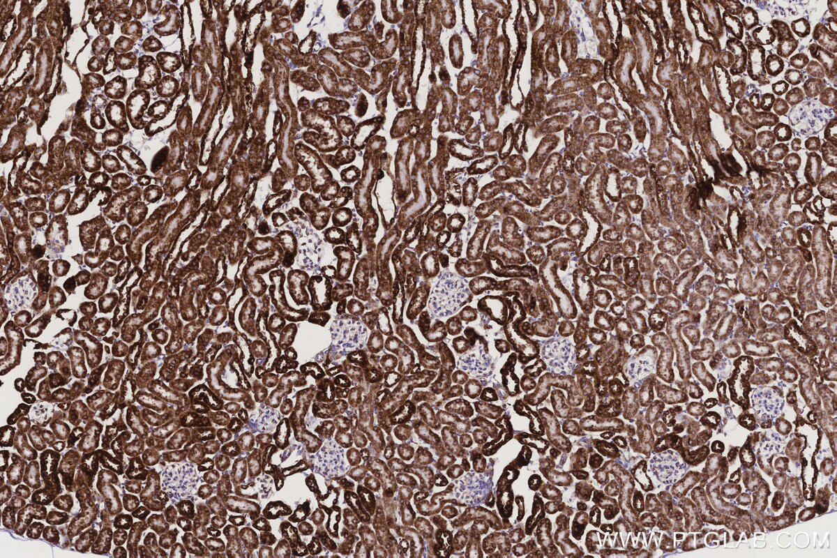 Immunohistochemical analysis of paraffin-embedded mouse kidney tissue slide using KHC3173 (COX6C IHC Kit). Immunohistochemical analysis of paraffin-embedded mouse kidney tissue slide using KHC3173 (COX6C IHC Kit).