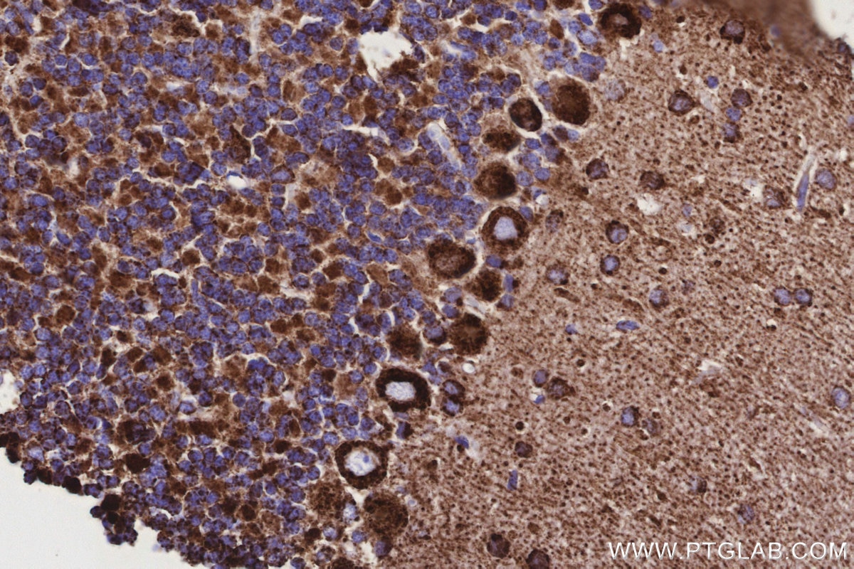 Immunohistochemical analysis of paraffin-embedded rat cerebellum tissue slide using KHC3173 (COX6C IHC Kit). Immunohistochemical analysis of paraffin-embedded rat cerebellum tissue slide using KHC3173 (COX6C IHC Kit).
