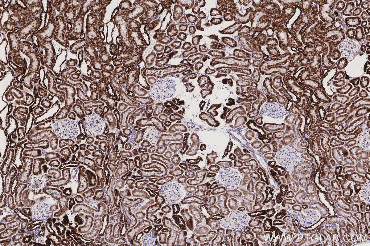 Immunohistochemical analysis of paraffin-embedded rat kidney tissue slide using KHC3173 (COX6C IHC Kit). Immunohistochemical analysis of paraffin-embedded rat kidney tissue slide using KHC3173 (COX6C IHC Kit).