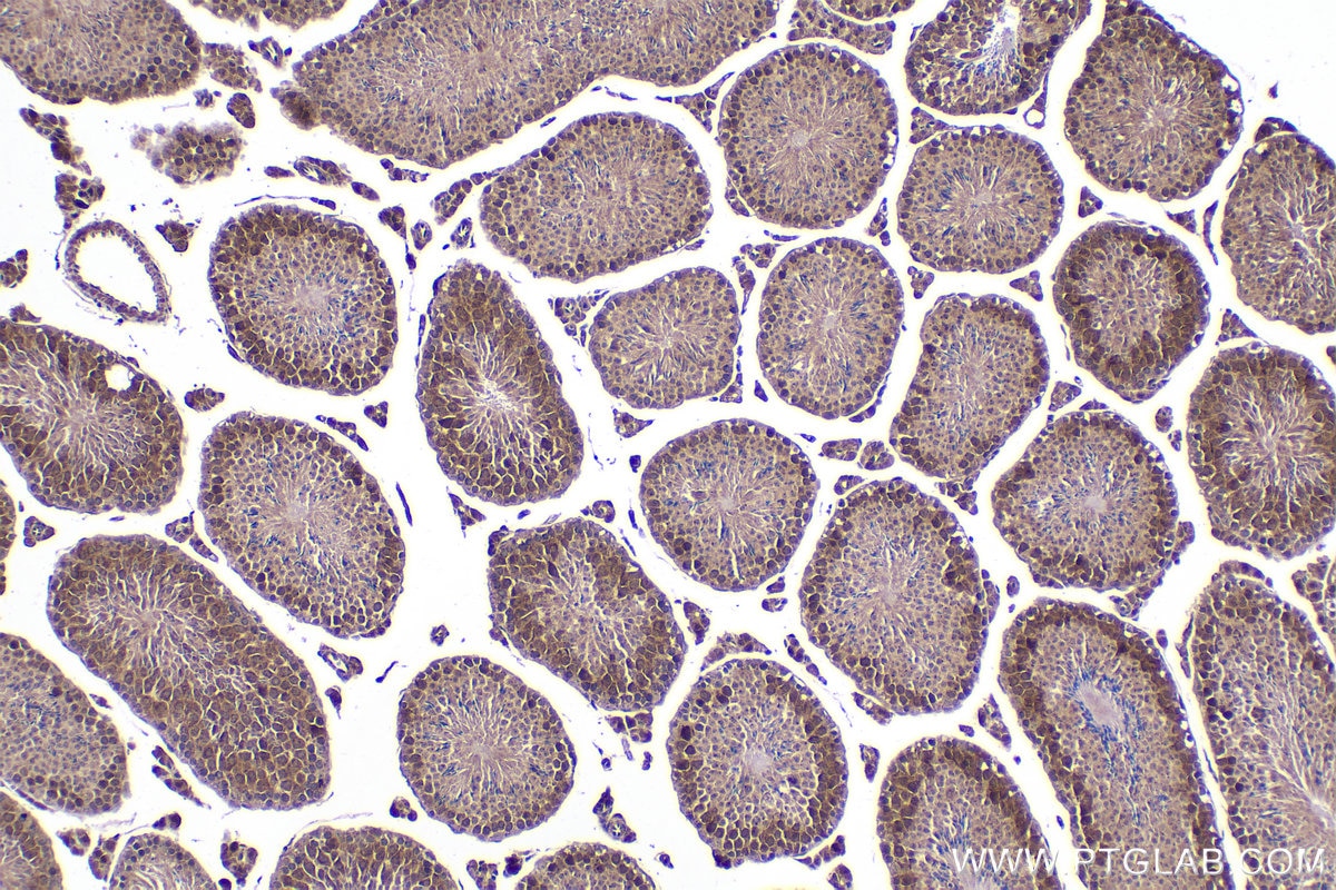 Immunohistochemical analysis of paraffin-embedded mouse testis tissue slide using KHC2079 (CP110 IHC Kit).