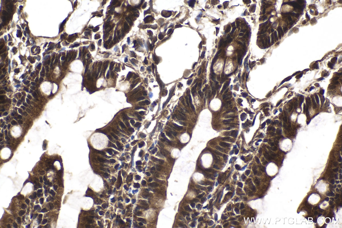 Immunohistochemical analysis of paraffin-embedded rat small intestine tissue slide using KHC2079 (CP110 IHC Kit).