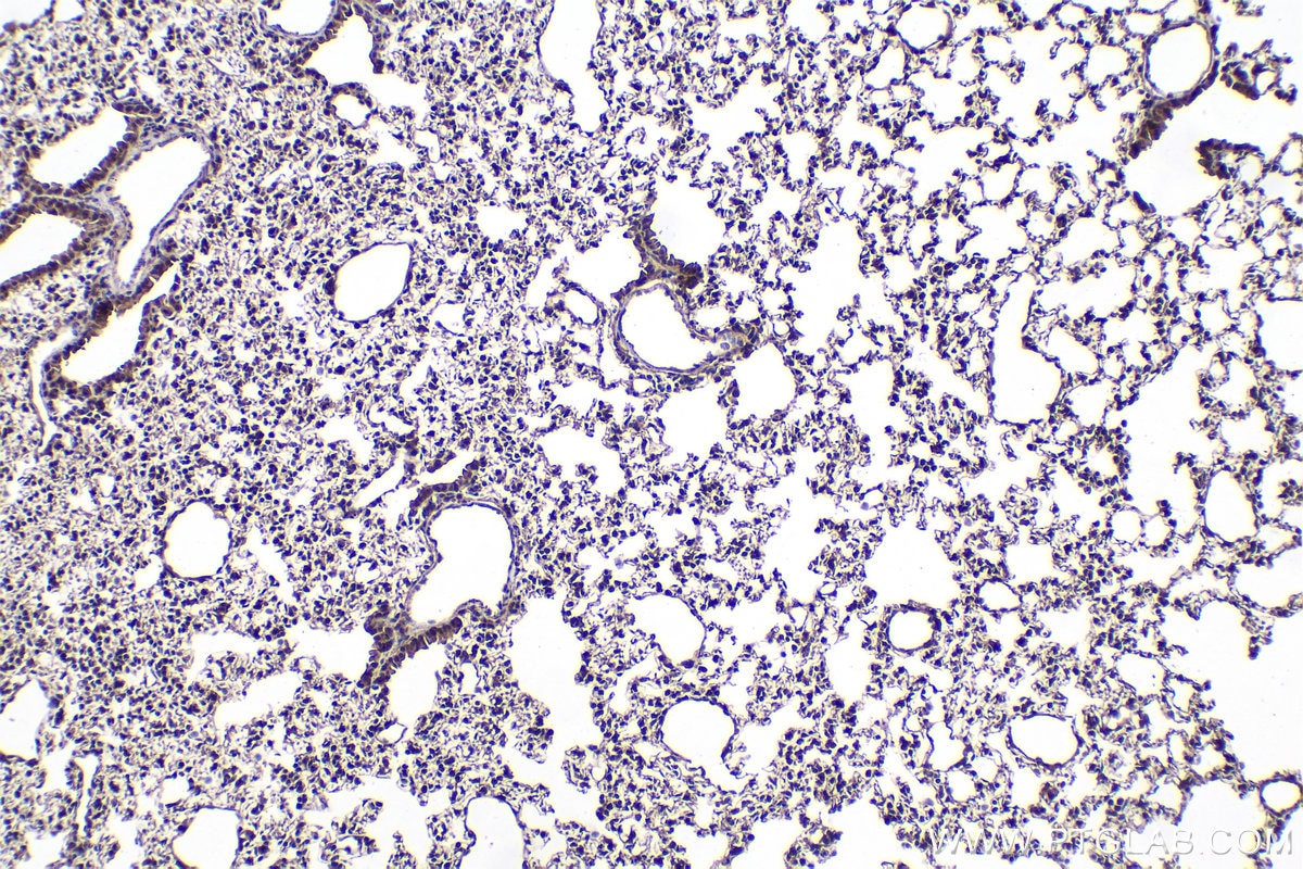 Immunohistochemical analysis of paraffin-embedded mouse lung tissue slide using KHC2079 (CP110 IHC Kit).