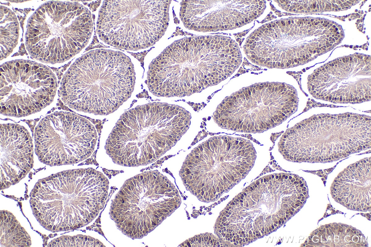 Immunohistochemical analysis of paraffin-embedded rat testis tissue slide using KHC2079 (CP110 IHC Kit).