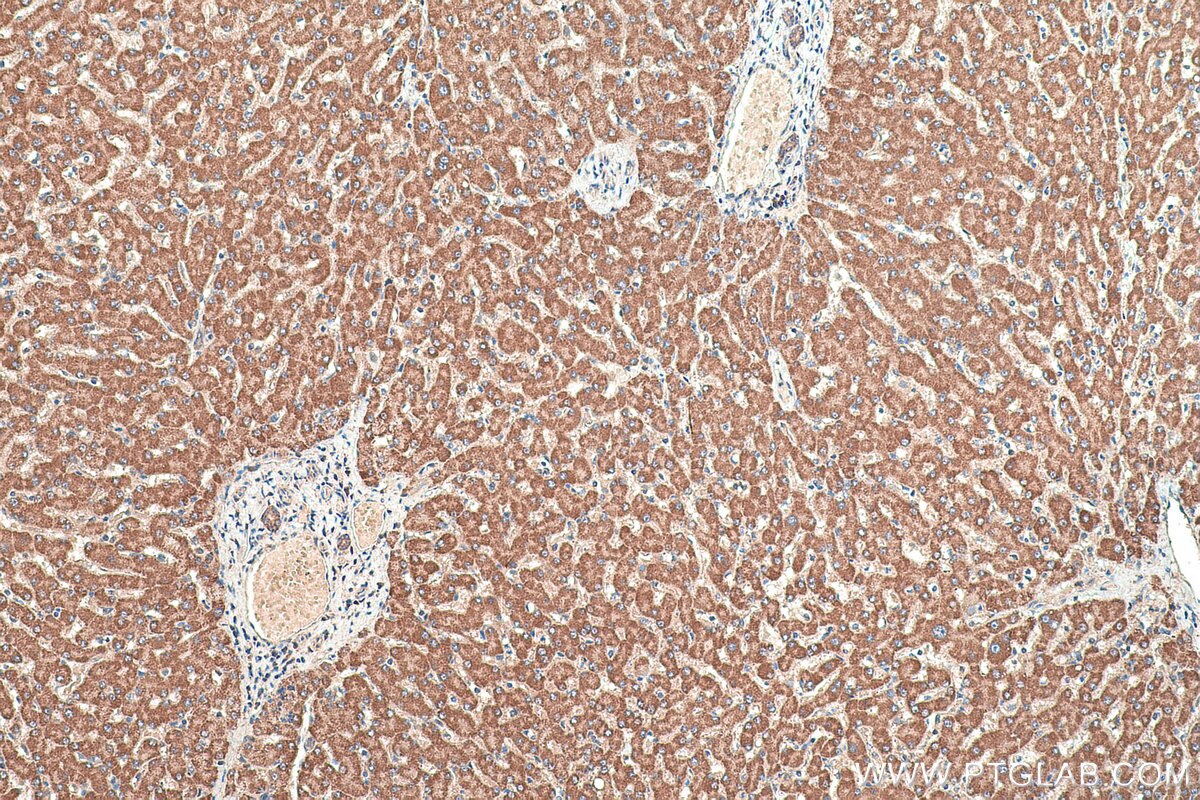 Immunohistochemical analysis of paraffin-embedded human liver tissue slide using KHC0411 (CPB2 IHC Kit).