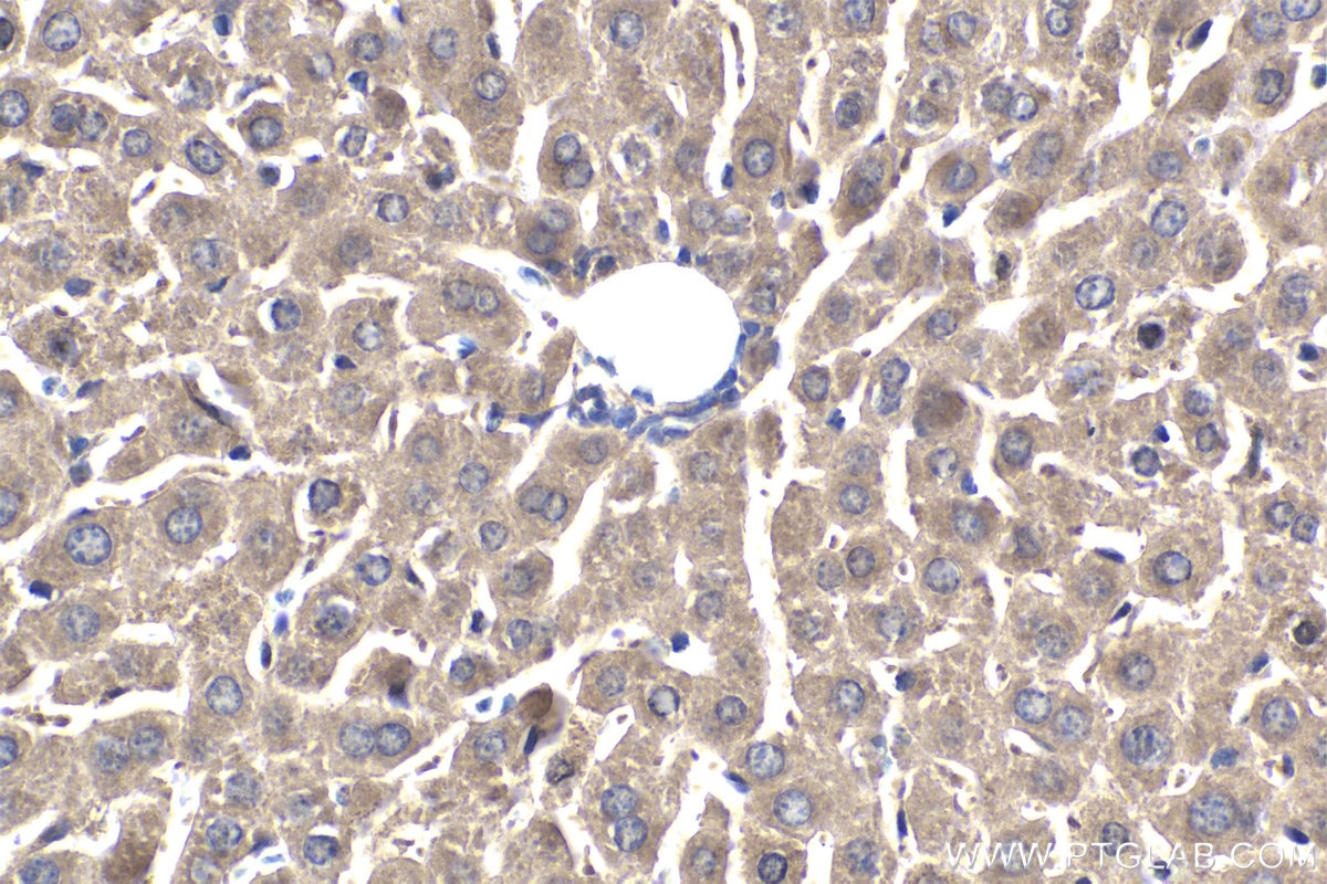 Immunohistochemical analysis of paraffin-embedded mouse liver tissue slide using KHC1835 (CPEB3 IHC Kit).