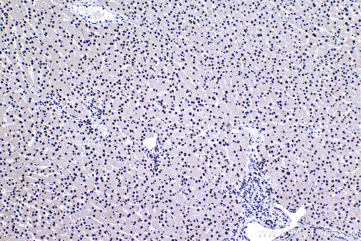 Immunohistochemical analysis of paraffin-embedded human liver tissue slide using KHC1388 (CPSF6 IHC Kit).