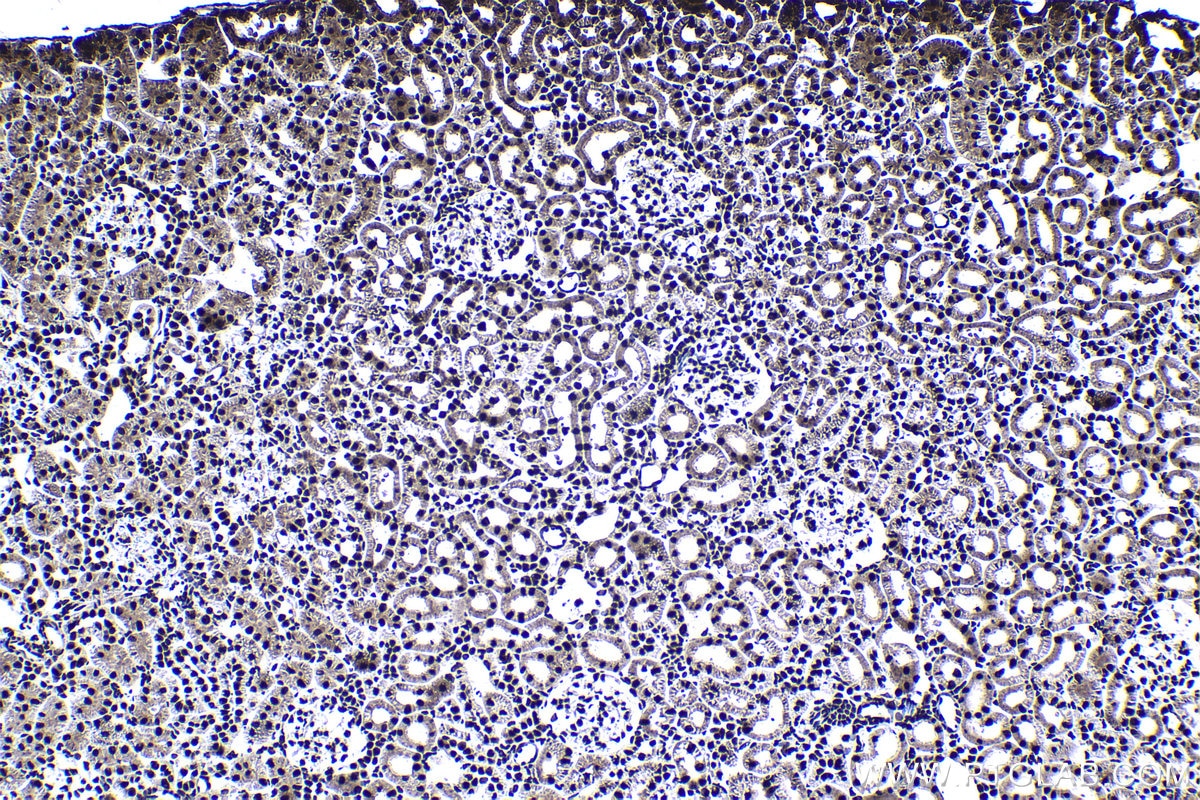 Immunohistochemical analysis of paraffin-embedded rat kidney tissue slide using KHC1388 (CPSF6 IHC Kit).